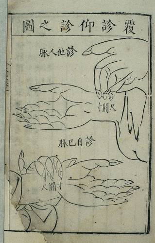 Woodcut illustration showing pulse diagnosis techniques known as fuzhen and yangzhen, Zhang Shixian (Ming period, 1368–1644)