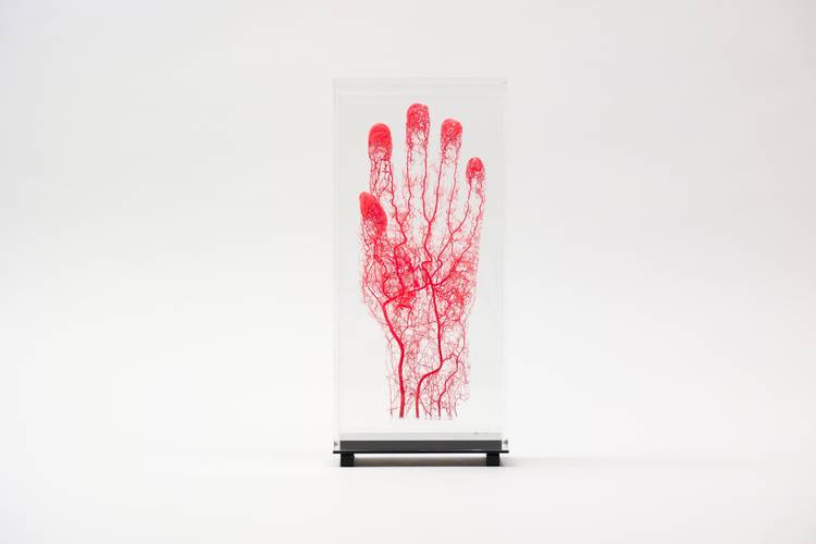 Korrosionspräparat, Gefässe der linken Hand (roter Kunststoff). Präparateur*in: Klaws (Kiel) und Heuckendorf (Berlin), Datierung: 2003. Sammlung: Sammlung am Centrum für Anatomie.
