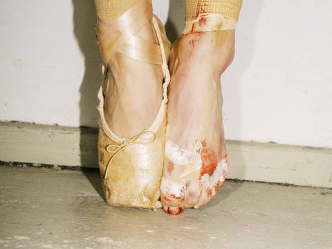 © Murat Aslan – Ein Fuß in einem Ballettschuh, der andere barfuß mit Pflastern und Blut. Beide auf einem Betonboden.