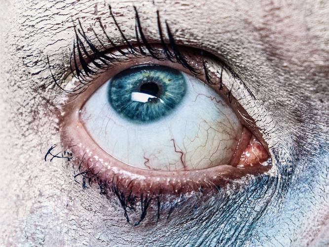 Nahaufnahme eines weit geöffneten Auges mit blauer Iris, umgeben von rissiger, hellfarbiger Haut. Deutlich sichtbare Wimpern und rote Äderchen.